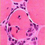Inflammation of Muscle Cells